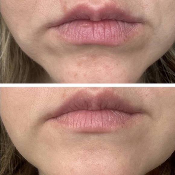 NATURE’S BOTOX IN A BOTTLE - Picture 5 of 9